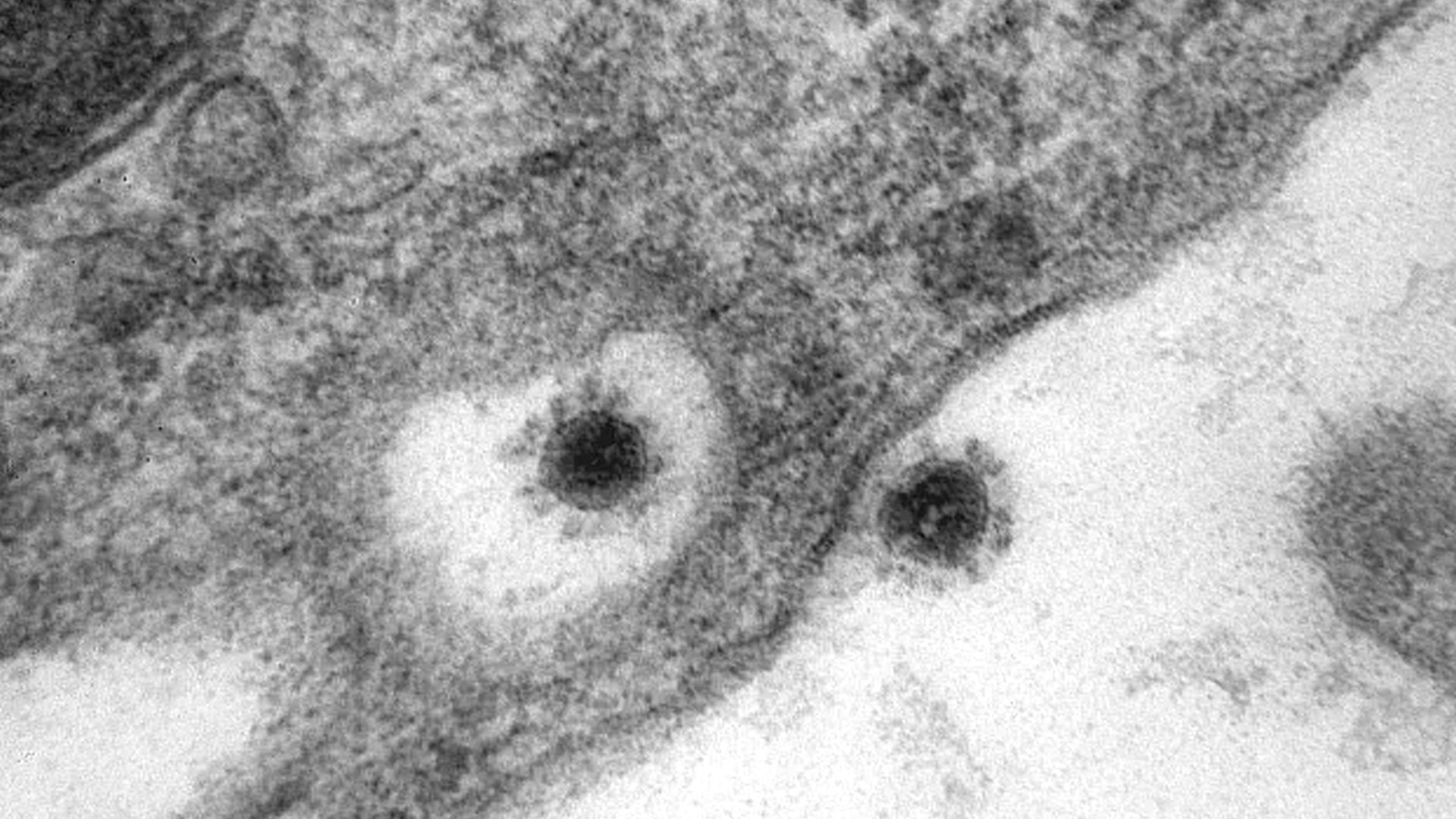 Штамм ковида 2024. SARS-cov-2 Дельта штамм. Вирус Covid 19 под микроскопом. Вирус SARS-cov-2 под микроскопом. Штаммы коронавируса под микроскопом.